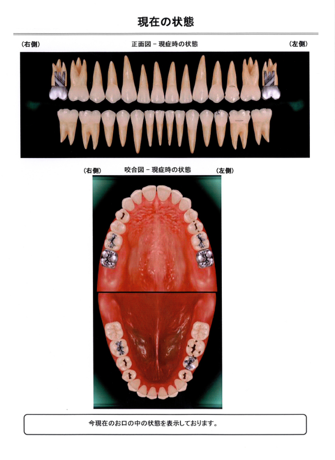 歯周病検査表1