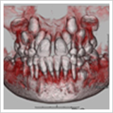 歯の生えてくる方向の診断1