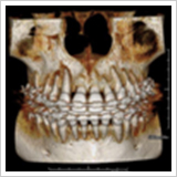 歯の生えてくる方向の診断2